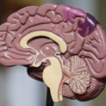 Gli effetti della schizofrenia sul cervello umano