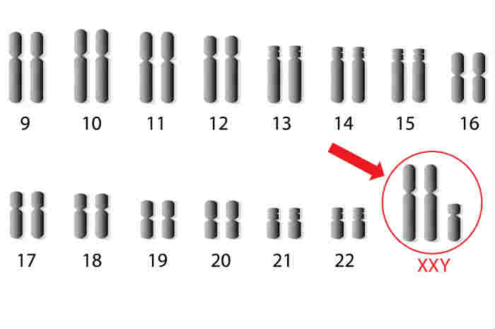 Sindrome di Klinefelter e Sessualità